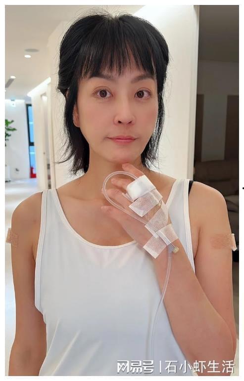 切除子宫的明星